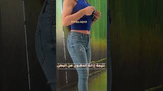 shorts عملية نحت البطن