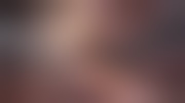 The Critical View of Safety Approach for Laparoscopic Cholecystectomy