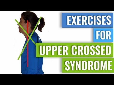 Video: Upper Crossed Syndrome: Oefeningen, Behandelingen En Symptomen