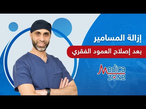 هل يحتاج المريض ازالة المسامير بعد عملية اصلاح العمود الفقري دكتور يحيى البرمبلي