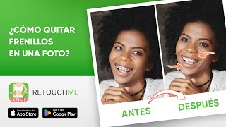 Consigue una sonrisa de confianza con el servicio de edición Quitar aparato de RetouchMe screenshot 4