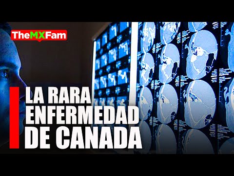 La Misteriosa Nueva Enfermedad de Canadá que nadie ha podido resolver