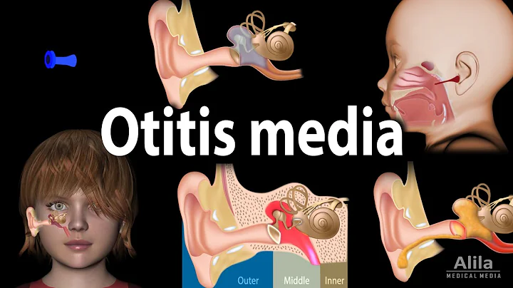 Otitis Media: Anatomy, Pathophysiology, Risk Factors, Types of OM, Symptoms and Treatment, Animation - DayDayNews