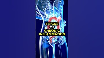 5 Signs of Chronic Inflammation #chronicinflammation #inflammation #ytshorts #ytshortsindia