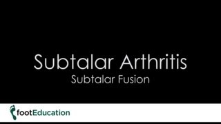 FootEd- Subtalar Arthritis- Subtalar Fusion