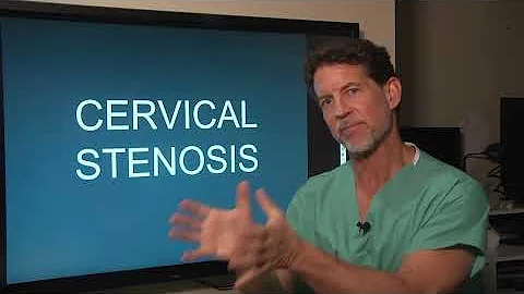 ¿Cuáles son los signos de la estenosis cervical?