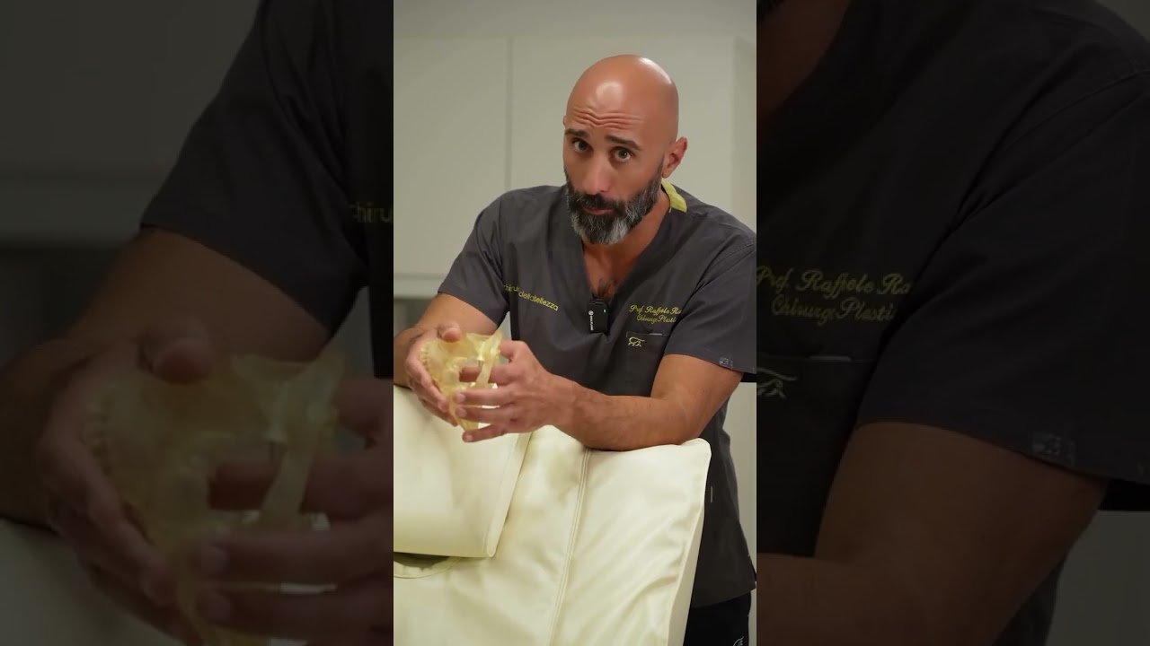 RINOPLASTICA DI REVISIONE O INTERVENTO SECONDARIO