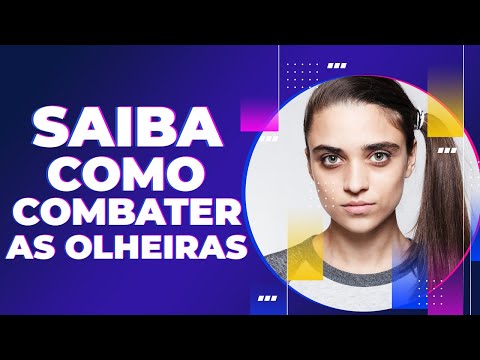 Vídeo: Olheiras - As Causas Da Aparência, Como Remover?