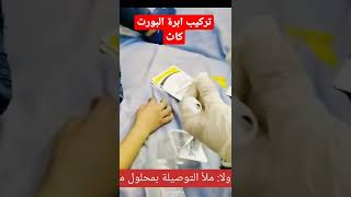 تركيب ابرة البورت كاث port cath needle #shorts