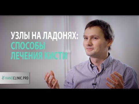 Контрактура Дюпюитрена: что делать, когда на ладони появляются узлы и пальцы рук не разгибаются?