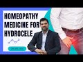 Hydrocele treatment without surgery  homeopathy medicines for hydrocele