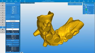 RealGUIDE Software:- Surgical Guide Modeling- Part 2