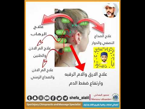خمس نقاط مهمة بالراس لعلاج الصداع الدوار طنين الأذن الرهاب ضغط الدم الام الرقبة