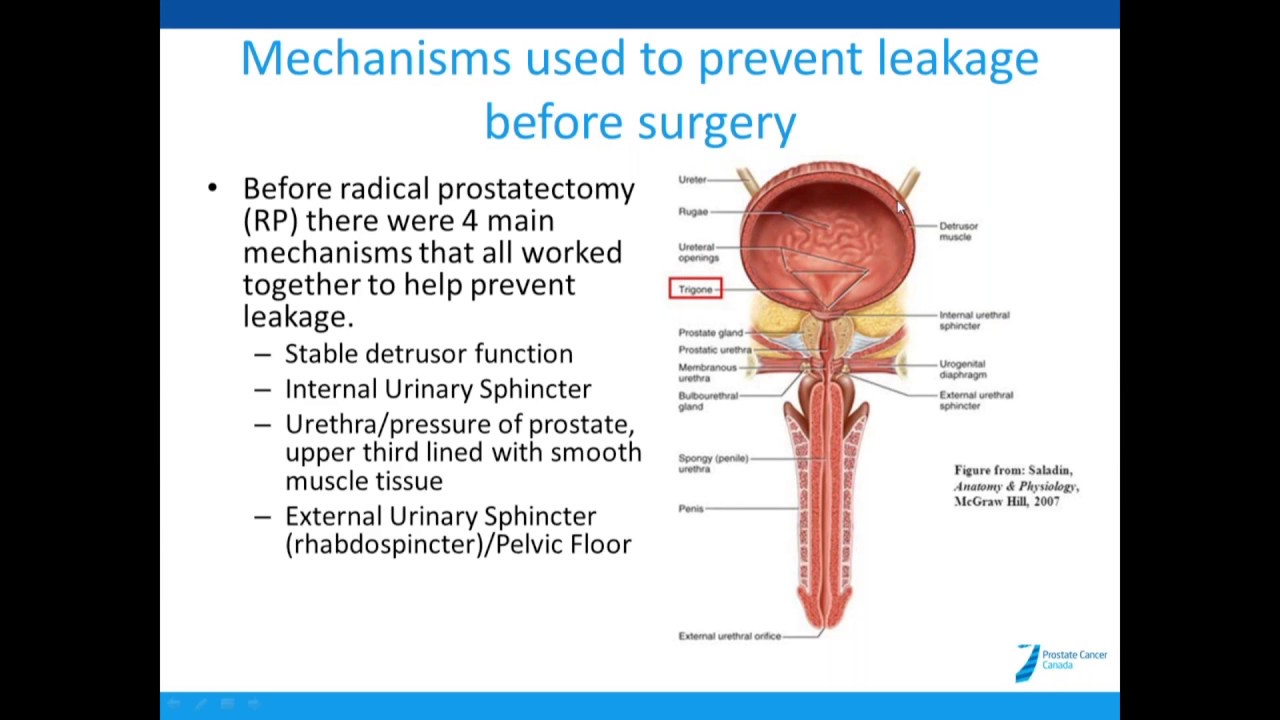 prostate removal recovery laser prostate surgery vs turp