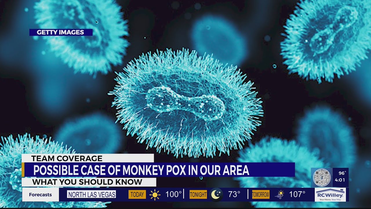 Possible Case of Monkey Pox in Our Area