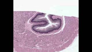 Shotgun Histology Esophagus.mp4