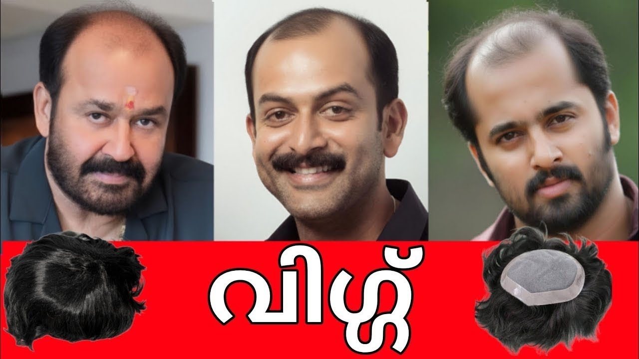 Malayalam Actors Who Use Hair Wigs – Industry Truth Revealed 😱