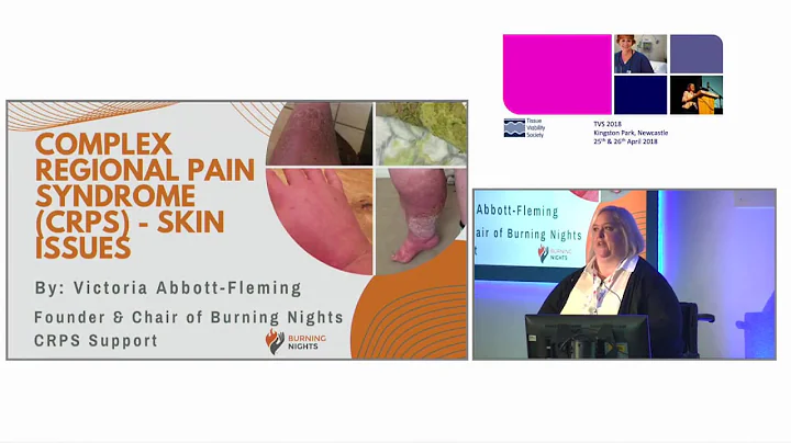 TVS 2018 - The Conference - Victoria Abbott Fleming