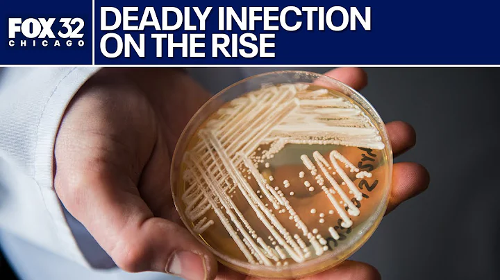 Deadly fungal infection Candida auris on the rise in Illinois | ChicagoNOW