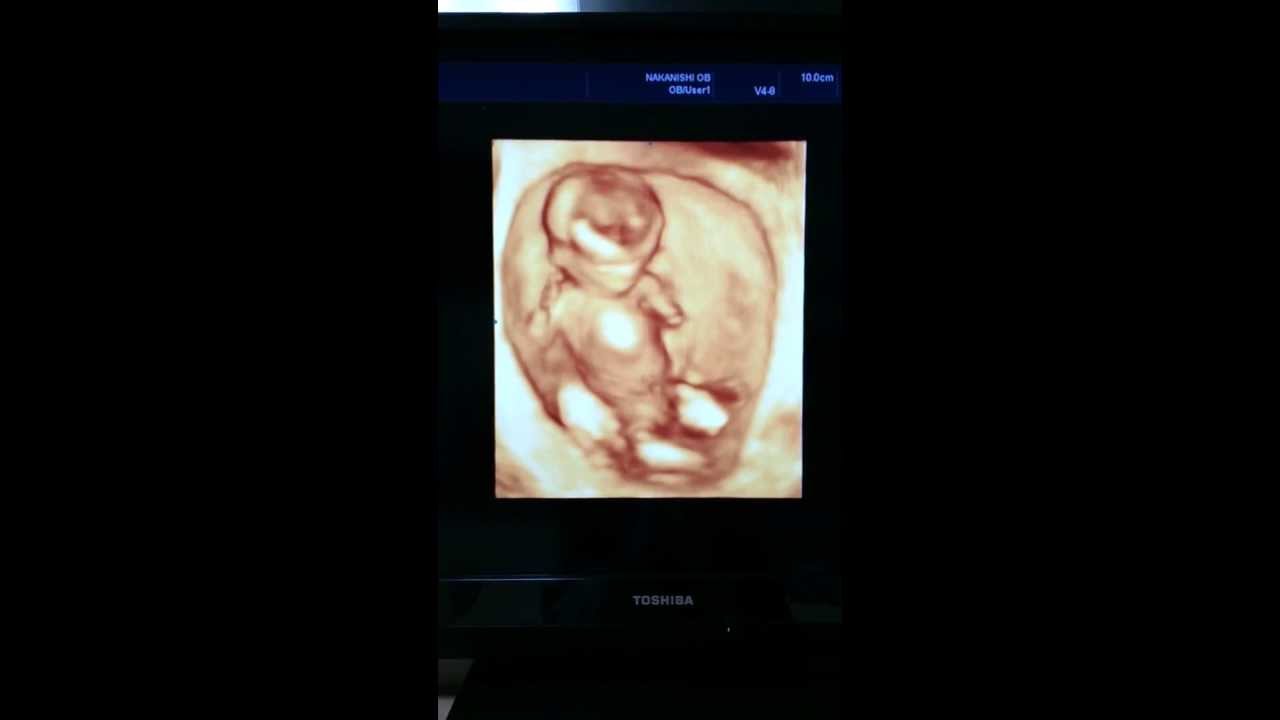 12週 胎児 4dエコー Youtube