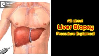 What is Liver Biopsy & Why is it done? Procedure | Diagnose Fast! -Dr. Ravindra BS | Doctors' Circle