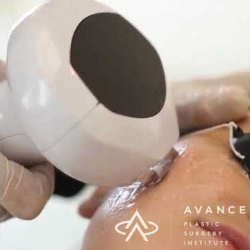 Lumecca IPL (Intense Pulsed Light)