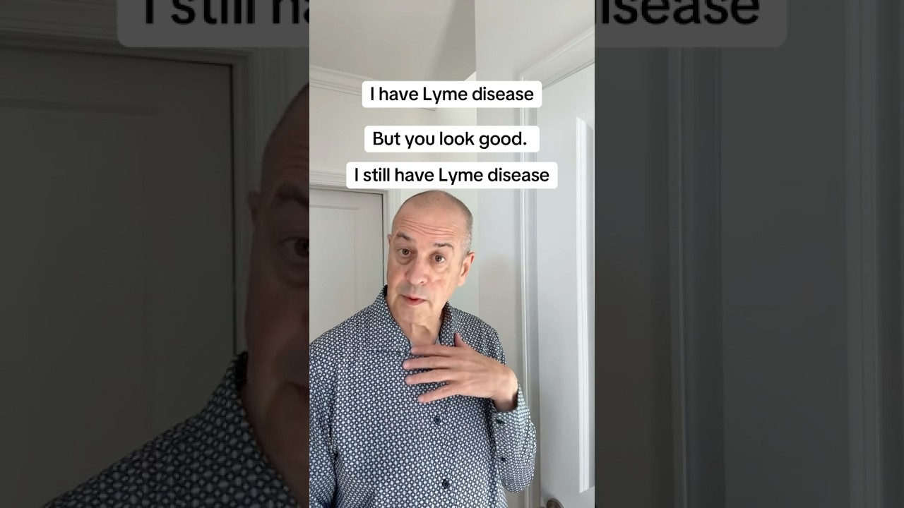 My Lyme disease was dismissed as ‘I looked good’.