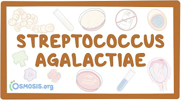 Come si cura Streptococcus Agalactiae?