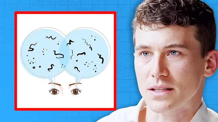 Eye Doctor: The Truth About Floaters and When to Worry | Dr. Joseph Allen