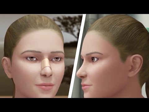 #კაცებისდრო ხელოვნური სილამაზე / ოჯახური ძალადობა