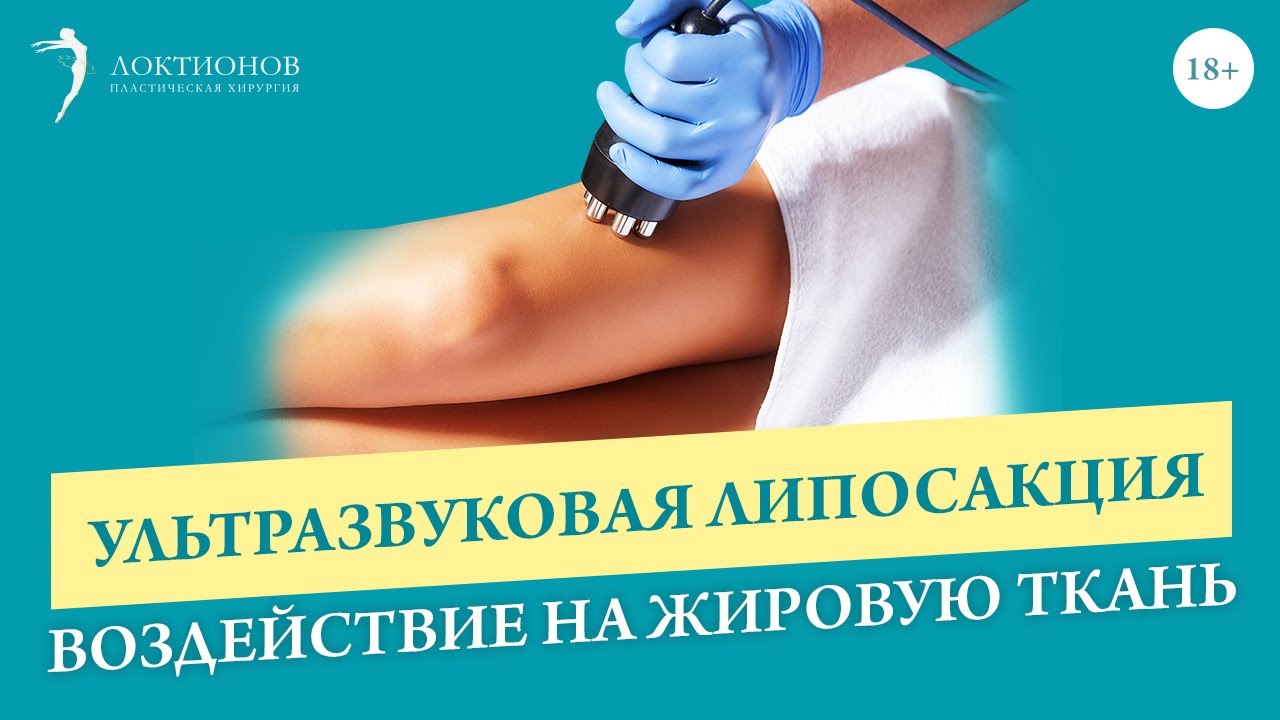 Ультразвуковая липосакция: особенности и эффективность данной методики / 18+