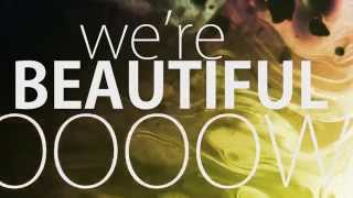 Zedd feat. Jon Bellion - Beautiful Now (TWOLOUD Remix)