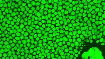 JID July 2025 Cover: Skin-associated cartilage featuring green-fluorescent lipid vacuoles