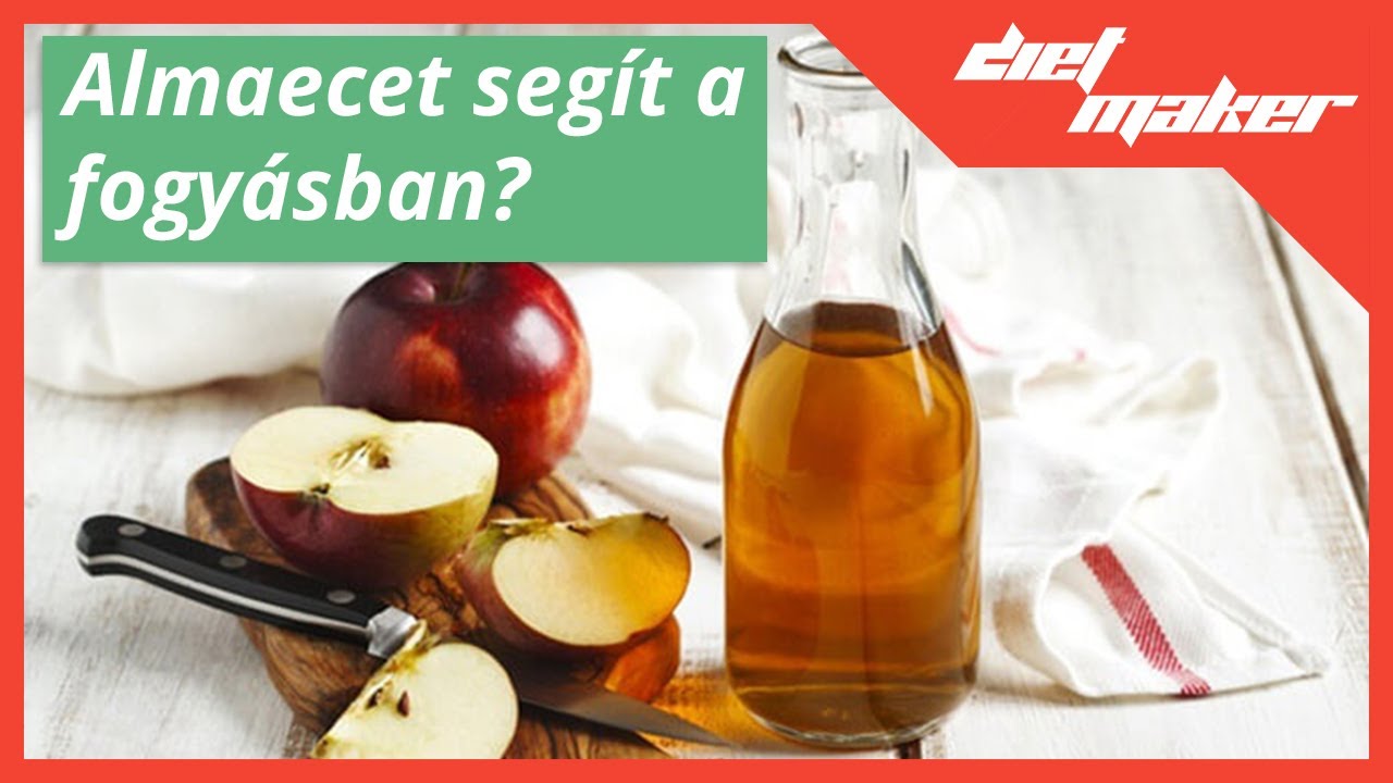 visszerek a lábak terhesség alatt hogyan kell kezelni