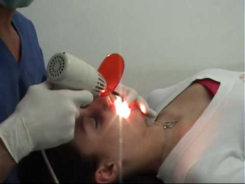 BRILLANTINO AL DENTE BERGAMO ANDREA RE SOLE PORDENONE SACILE JESOLO DIAMOND  TOOTH, PIERCING, TATTOO 