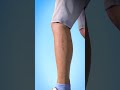 How Stitches Work in Human Skin 🩹 | Healing Process Explained