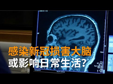 新冠后遗症全解读：感染新冠损害大脑或影响日常生活吗？| 专家解析 | SBS中文
