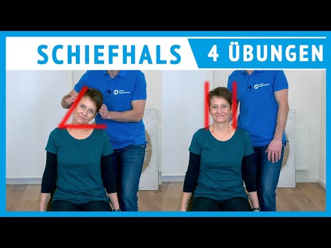 Video: Spastische Torticollis - Behandlung, Prognose