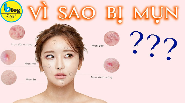 Mặt nổi mụn nhiều là bệnh gì