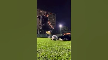 Before and after scalp micro pigmentation #scalpmicropigmentationindia #scalpmicropigmentation #smp