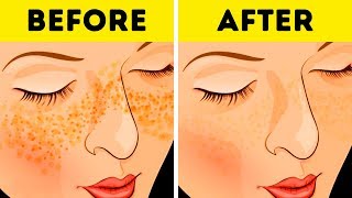 22 LIFE HACKS FOR YOUR SKIN