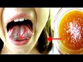 Just Put Salt Sugar Mixture Under Your Tongue Before You Go to Sleep!