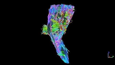 2021 Second Place Video (tie): Pyramidal Tract Reconstruction in vivo