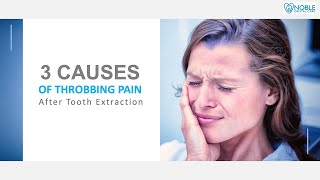 3 Causes of Throbbing Pain After Tooth Extraction