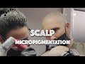 Ink 2 scalp micropigmentation  1 smp studio in ontario