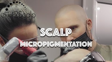 Ink 2 Scalp Micropigmentation - #1 SMP Studio in Ontario
