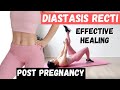 EPIC lower ab exercises for diastasis recti, midsection. Post weight loss, postpartum P3