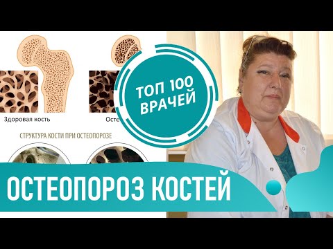 Остеопороз: симптомы и лечение остеопороза. Профилактика и как лечить остеопению