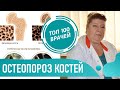 Что такое Остеопороз. Симптомы и лечение остеопороза. Профилактика и как лечить остеопороз костей