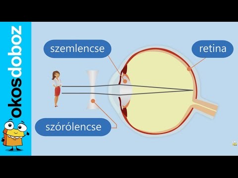 Videó: Szemüveg és Vizes Humor Diagram és Működése Test Térképek